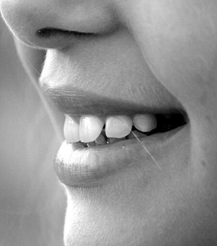 hambaimplantaadid-mitteariline-kasutusoigus-450×570